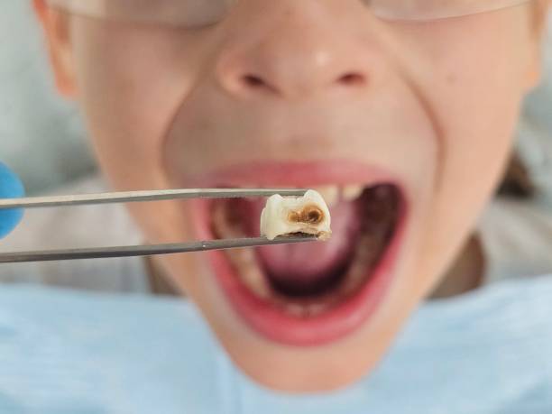 Best Emergency Care for Gum Disease in Beggs, OK